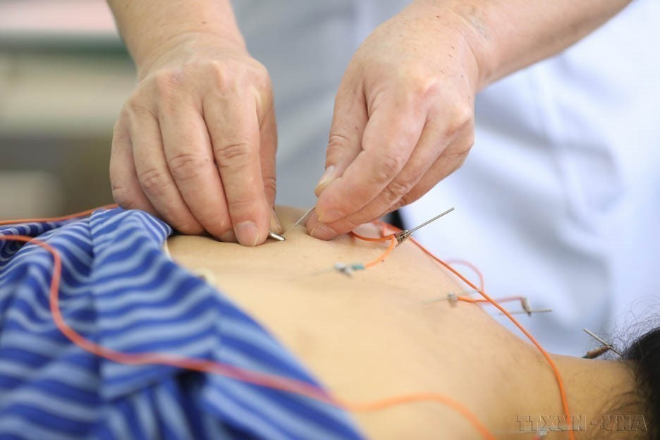 谅山省传统医学院采用电针疗法为病人治疗。图自越通社