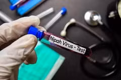 印尼呼吁对尼帕病毒提高警惕