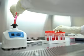 全国新增确诊病例 77982 例 河内市近1.1万例