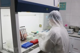 新冠肺炎疫情：越南成功研制出新冠病毒检测试剂盒