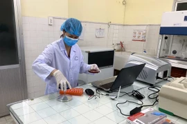 新冠肺炎疫情：安沛省疾病预防与控制中心达到疫情检测标准