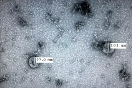 新型冠状病毒感染肺炎疫情：越南成功培养和分离新型冠状病毒毒株