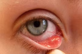 附图。（图片来源：互联网）