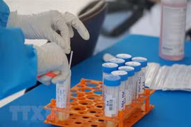 7月3日越南新增新冠肺炎确诊病例数创下新纪录 达922例