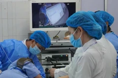 越南九龙江三角洲地区首次开展超声内镜技术。图自互联网