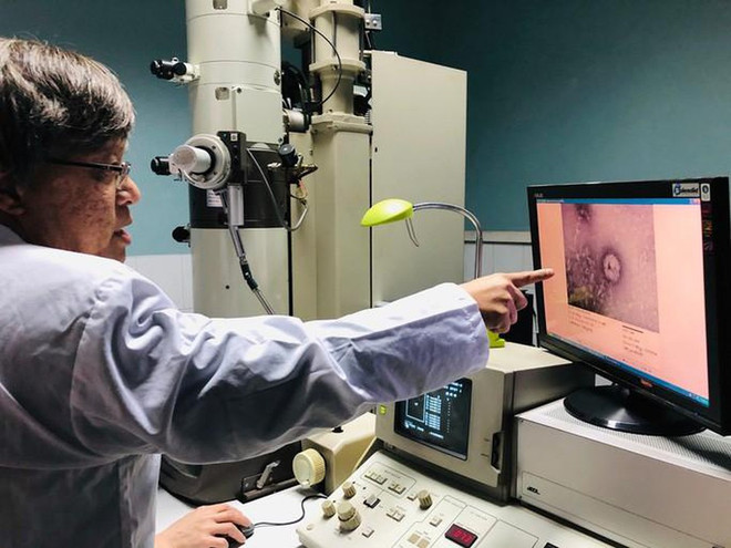 新冠肺炎疫情:快速检测新冠病毒试剂盒临床样本试验结果将尽早公布 ảnh 1 新冠肺炎疫情:快速检测新冠病毒试剂盒临床样本试验结果将尽早公布 ảnh 1