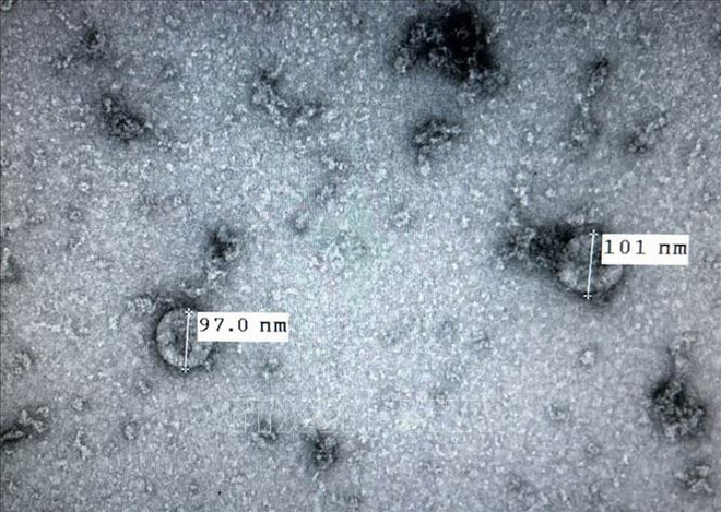 新型冠状病毒感染肺炎疫情：越南成功培养和分离新型冠状病毒毒株 ảnh 1