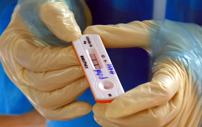 越南发布新版新冠病毒肺炎防控指南 ảnh 1 越南发布新版新冠病毒肺炎防控指南 ảnh 1