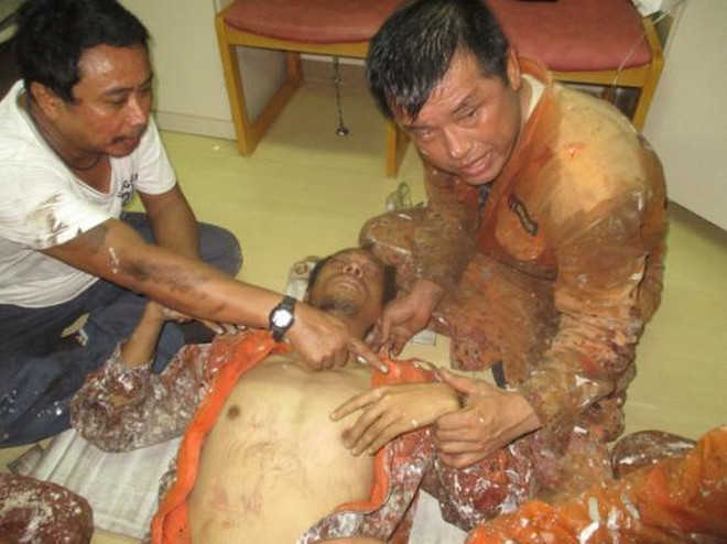 越南紧急救助一名海上病危外籍船员 ảnh 1 越南紧急救助一名海上病危外籍船员 ảnh 1