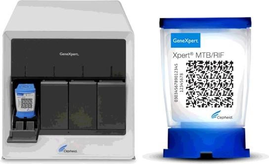 结核病防治计划Gene Xpert 检测系统可参与新冠肺炎病毒检测 ảnh 1 结核病防治计划Gene Xpert 检测系统可参与新冠肺炎病毒检测 ảnh 1