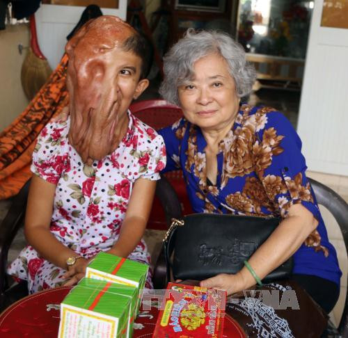 旅法越侨陈素娥起诉美国化工公司案得到广泛的支持 ảnh 2 旅法越侨陈素娥起诉美国化工公司案得到广泛的支持 ảnh 2