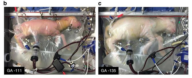 越通社评选2017年世界十大新闻事件 ảnh 10 越通社评选2017年世界十大新闻事件 ảnh 10
