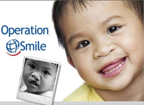 河内和胡志明两大城市唇腭裂畸形患者将接受免费手术 ảnh 1 河内和胡志明两大城市唇腭裂畸形患者将接受免费手术 ảnh 1