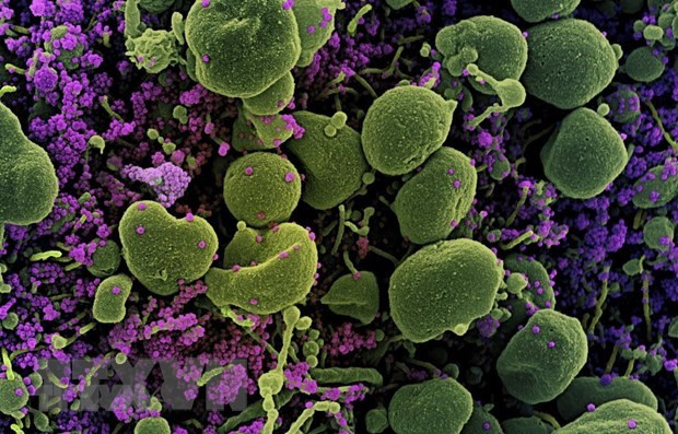 破译河内和海阳两个省市的患者新冠病毒基因序列确定病毒变异 ảnh 1 破译河内和海阳两个省市的患者新冠病毒基因序列确定病毒变异 ảnh 1