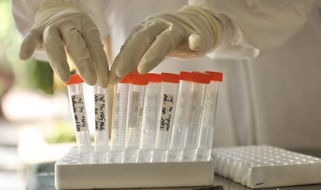 7月8日早上越南胡志明市和平阳省新增314例新冠肺炎确诊病例 ảnh 1 7月8日早上越南胡志明市和平阳省新增314例新冠肺炎确诊病例 ảnh 1