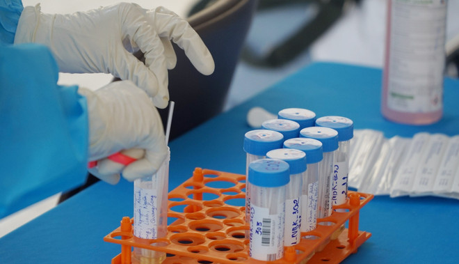 7月6日中午越南新增248例确诊病例 其中输入性病例6例 ảnh 1 7月6日中午越南新增248例确诊病例 其中输入性病例6例 ảnh 1