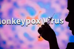 外交部例行记者会：越南尚未出现猴痘病例