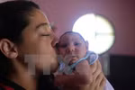 孕妇感染寨卡病毒导致新生儿小头症（来源：越通社）
