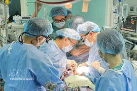 顺化中央医院医生实施第20例心脏移植手术。图自越通社