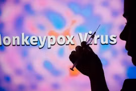 外交部例行记者会：越南尚未出现猴痘病例