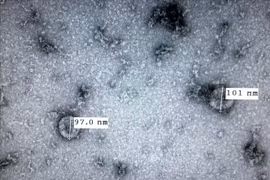 新型冠状病毒感染肺炎疫情：越南成功培养和分离新型冠状病毒毒株