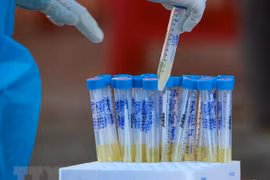 越南新增2例输入性新冠肺炎确诊病例