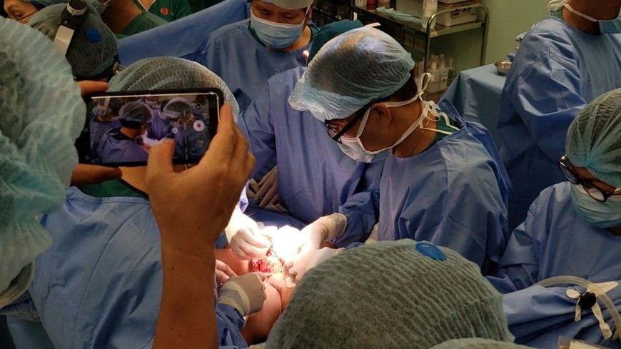 据悉，这类手术在世界上的比例仅为 6%。图片来源：胡志明市儿童医院