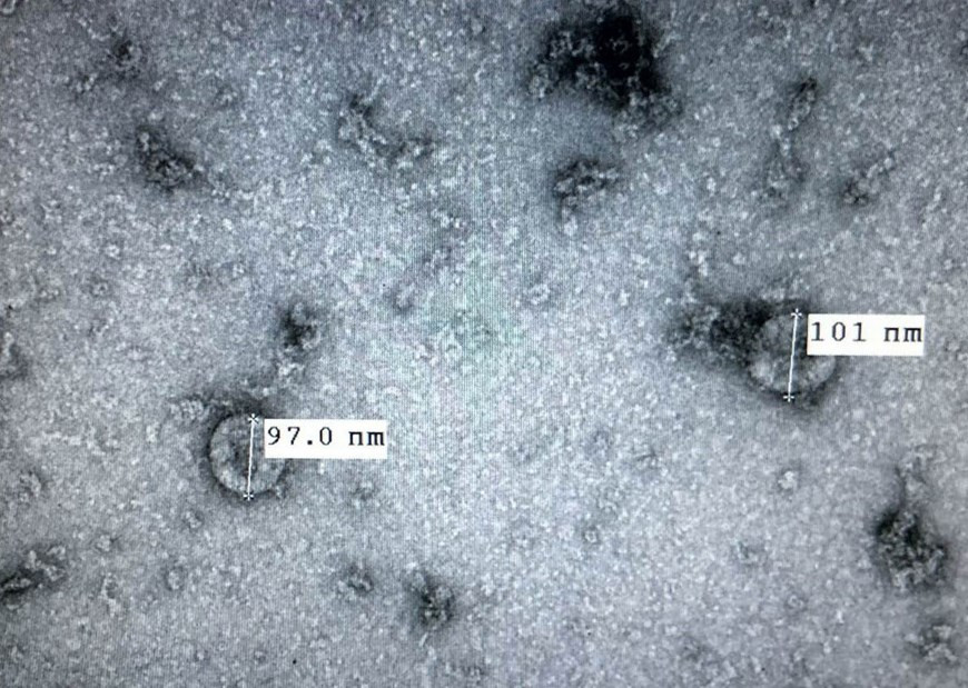 2020年2月7日，越南中央卫生与流行病学研究院宣布成功培养和分离了引起新冠肺炎（COVID-19）的新冠状病毒（nCoV），为病毒感染和疑似感染病例检测创造了便利条件。其为研究和开发新冠疫苗奠定基础。图自越通社