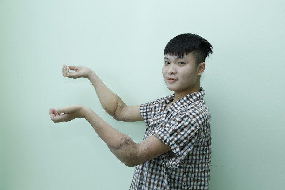 这是越南医学的新奇迹。图自越通社