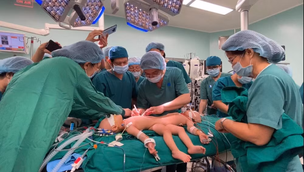 国际媒体纷纷报道越南下半身连体双胞胎女婴分离手术顺利成功 ảnh 1 国际媒体纷纷报道越南下半身连体双胞胎女婴分离手术顺利成功 ảnh 1