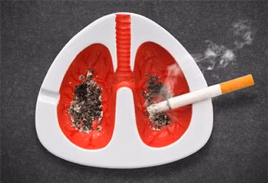 越南：吸烟导致约96.8%的肺癌患者死亡 ảnh 1