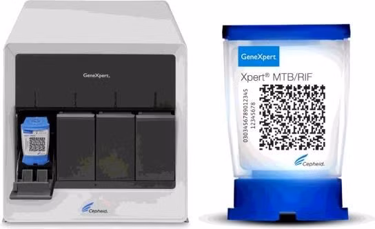 结核病防治计划Gene Xpert 检测系统可参与新冠肺炎病毒检测 ảnh 1